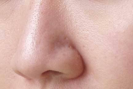 pores on face. Pores are tiny openings in the