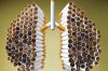 Thumbnail of How Does Cigarette Smoking Affect Your Lungs ?