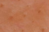 How to Reduce Open Pores on Face Thumbnail of How to Reduce Open Pores on Face