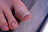 Thumbnail of What’s the Best Cure For Toenails Fungus ?