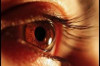 Thumbnail of Eye Symptoms of High Blood Pressure