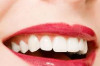 How To Naturally Whiten Teeth Thumbnail of How To Naturally Whiten Teeth