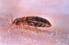 Thumbnail of How to Get Rid of Bed Bugs at Home Naturally
