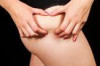 How to Lose Weight in Thighs and Hips Thumbnail of How to Lose Weight in Thighs and Hips