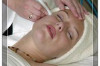 Aluminum Oxide for Microdermabrasion Thumbnail of Aluminum Oxide for Microdermabrasion