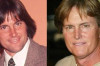 Worst Plastic Surgery – Bruce Jenner Thumbnail of Worst Plastic Surgery – Bruce Jenner