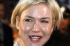 Tips to Avoid Oily Face Thumbnail of Tips to Avoid Oily Face