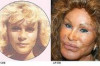 Thumbnail of Jocelyn Wildenstein Before and After Plastic Surgery