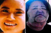 Worst Surgical Mistakes Thumbnail of Worst Surgical Mistakes