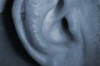 Ear Reduction Surgery – Before and After Photos – Cost Thumbnail of Ear Reduction Surgery – Before and After Photos – Cost