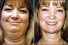 How to Lose Double Chin Fat Fast Thumbnail of How to Lose Double Chin Fat Fast