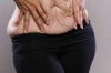 How to Avoid Stretch Marks While Losing Weight Thumbnail of How to Avoid Stretch Marks While Losing Weight
