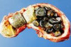 How to Flush Gallstones Thumbnail of How to Flush Gallstones