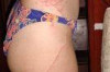 Jellyfish Sting Home Remedy Thumbnail of Jellyfish Sting Home Remedy