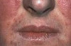 How to Treat Uneven Skin Tone Thumbnail of How to Treat Uneven Skin Tone