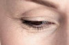 How to Prevent Wrinkles Around Eyes Thumbnail of How to Prevent Wrinkles Around Eyes