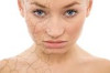 Home Remedies for Skin Discoloration Thumbnail of Home Remedies for Skin Discoloration