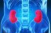 How to Take Care of Your Kidneys Thumbnail of How to Take Care of Your Kidneys