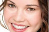 How to Whiten Teeth with Braces Thumbnail of How to Whiten Teeth with Braces
