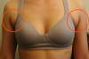 How to Get Rid of Underarm Fat Thumbnail of How to Get Rid of Underarm Fat