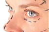 How to Prepare for Plastic Surgery Thumbnail of How to Prepare for Plastic Surgery