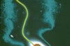 How to Treat Cholera Thumbnail of How to Treat Cholera