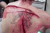 First Aid for Deep Cuts Thumbnail of First Aid for Deep Cuts