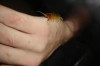 How to Treat a Centipede Bite Thumbnail of How to Treat a Centipede Bite
