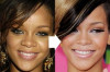 Rihanna Before and After Plastic Surgery Thumbnail of Rihanna Before and After Plastic Surgery