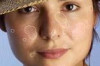 How to Get Rid of Blemishes Overnight Thumbnail of How to Get Rid of Blemishes Overnight