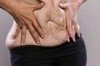 How to Get Rid of Loose Skin after Weight Loss Thumbnail of How to Get Rid of Loose Skin after Weight Loss