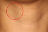 How to Get Rid of Neck Wrinkles Thumbnail of How to Get Rid of Neck Wrinkles