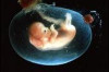 How to Increase Amniotic Fluid Thumbnail of How to Increase Amniotic Fluid