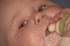 Signs of Lactose Intolerance in Babies Thumbnail of Signs of Lactose Intolerance in Babies
