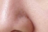 How to Close your Pores on your Face Naturally Thumbnail of How to Close your Pores on your Face Naturally