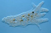 Home Remedies for Amoeba Thumbnail of Home Remedies for Amoeba