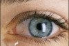 How to Cure Watery Eyes Thumbnail of How to Cure Watery Eyes
