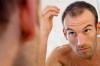 Home Remedies for Thinning Hair Thumbnail of Home Remedies for Thinning Hair