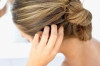 Home Remedies for Scalp Fungus Thumbnail of Home Remedies for Scalp Fungus