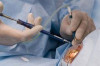 Eye Cataract Surgery, Its Cost, Treatment, and Recovery after Surgery Thumbnail of Eye Cataract Surgery, Its Cost, Treatment, and Recovery after Surgery