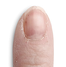 Nail Products for Peeling Nails