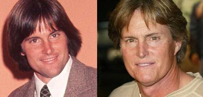 bruce jenner plastic-surgery before after