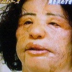 after photo - Plastic Surgeon Attempted to fix Hang Mioku's face