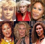 jocelyn wildenstein - Before and After Pictures