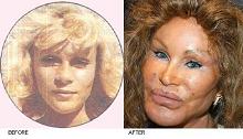 Jocelyn Wildenstein - Before and After Plastic Surgery