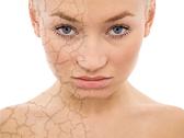 skin discoloration home remedies