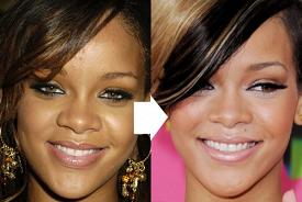rihanna nose job before and after picture