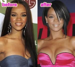 rihanna's breast surgery before and after
