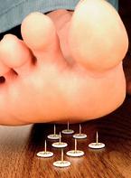 How to Treat Neuropathy