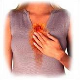 How to Treat Severe Heartburn